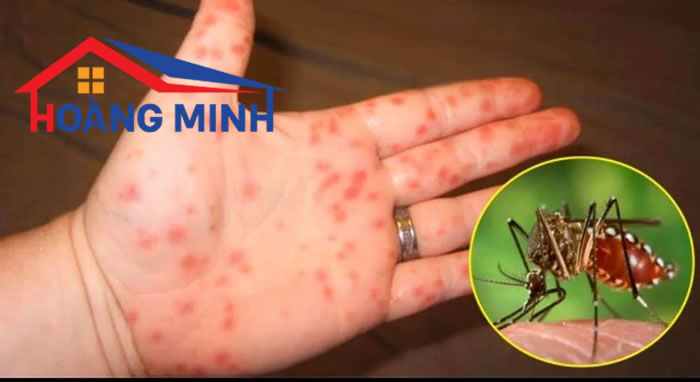 Sốt xuất huyết là bệnh truyền nhiễm nguy 
hiểm với muỗi là vật trung gian truyền bệnh