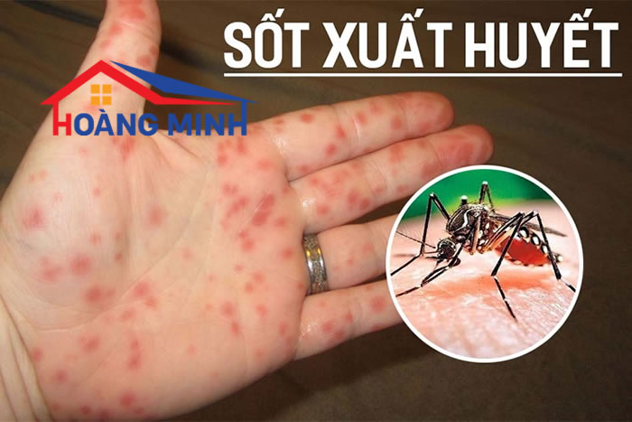 Muỗi đốt gây sốt xuất huyết