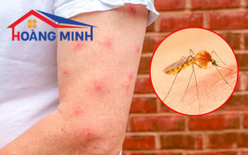 Những cách chống muỗi hiệu quả trong mùa hè