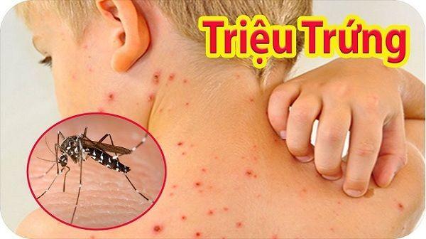 muỗi đốt là nguyên nhân chính dẫn 
đến bị sốt xuất huyết